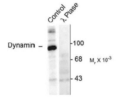 Western Blot: Dynamin [p Ser774] Antibody [NB300-209]